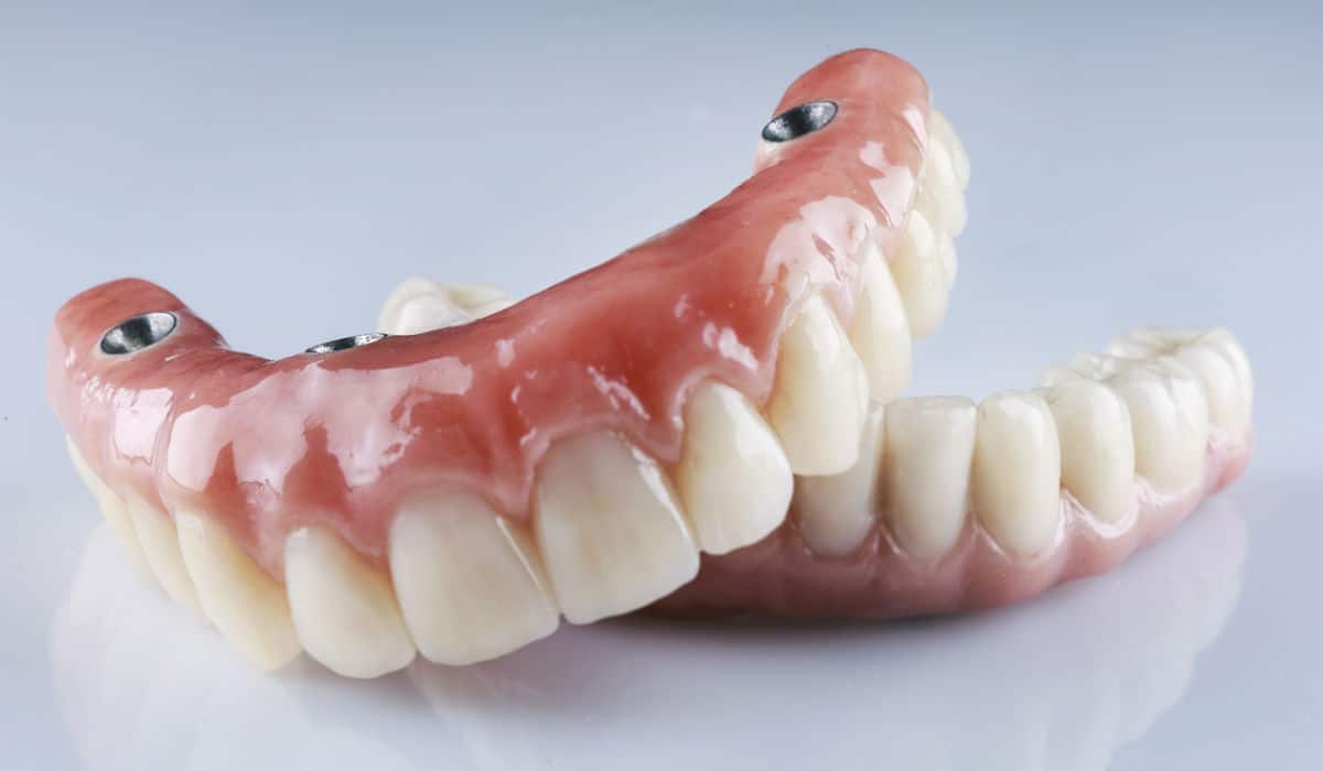 Se vería una prótesis dental